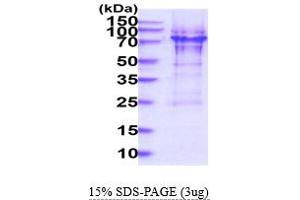 SDS-PAGE (SDS) image for Hemoglobin X, alpha-Like Embryonic Chain in Hba Complex (HBA-X) (AA 1-142) protein (His tag) (ABIN6388171)