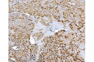 IHC analysis of CHAT using anti-CHAT antibody (ABIN7600920).