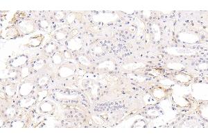 Detection of ICAM1 in Human Kidney Tissue using Monoclonal Antibody to Intercellular Adhesion Molecule 1 (ICAM1)