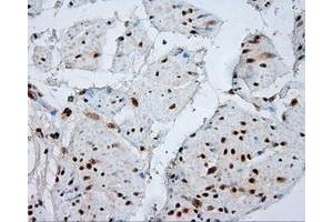 Image no. 2 for anti-Atrial Natriuretic Peptide Receptor 3 (NPR3) antibody (ABIN1499804) (NPR3 抗体)