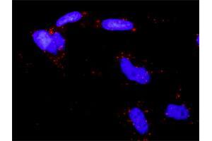 Proximity Ligation Analysis of protein-protein interactions between EPAS1 and SMAD3. (SMAD3 抗体  (AA 1-110))