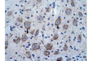 KCTD13 antibody was used for immunohistochemistry at a concentration of 4-8 ug/ml to stain Neural cells (arrows) in Human Brain. (KCTD13 抗体  (N-Term))