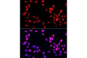 Immunofluorescence analysis of NIH-3T3 cells using Phospho-Histone H3-S10/T11 Rabbit pAb (ABIN7267688) at dilution of 100 (40x lens).