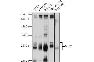 Western blot analysis of extracts of various cell lines, using MUC1 antibody (ABIN6131522, ABIN6144194, ABIN6144195 and ABIN6213810) at 1:1000 dilution. (MUC1 抗体  (AA 1182-1255))