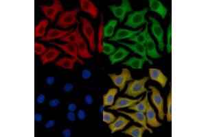 c-Kit Mouse Monoclonal Antibody staining HepG2 cells by IF/ICC. (KIT 抗体  (Internal Region))