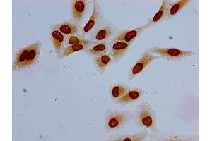 Immunocytochemistry analysis of Hela cells using ABIN7139191 at dilution of 1:100 (HIST1H1E 抗体  (acLys63))