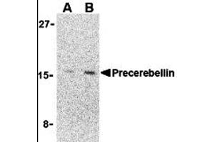 Western Blotting (WB) image for anti-Cerebellin 1 Precursor (CBLN1) (C-Term) antibody (ABIN1030599) (CBLN1 抗体  (C-Term))