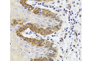 Immunohistochemistry of paraffin-embedded Human trachea using ESD Polyclonal Antibody at dilution of 1:100 (40x lens). (Esterase D 抗体)