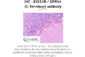 Image no. 2 for anti-KISS1 Receptor (KISS1R) (C-Term) antibody (ABIN1736238) (KISS1R 抗体  (C-Term))