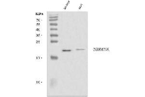 Western blot analysis of TOMM20L using anti-TOMM20L antibody (ABIN7602937).