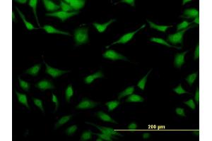 Immunofluorescence of monoclonal antibody to STAU2 on HeLa cell. (Double-stranded RNA-binding protein Staufen homolog 2 (STAU2) (AA 341-440) 抗体)