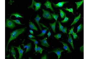 Immunofluorescence staining of U251 cells with ABIN7146919 at 1:100, counter-stained with DAPI. (CARD6 抗体  (AA 666-930))