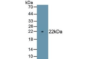 Detection of Recombinant PMP22, Rat using Polyclonal Antibody to Peripheral Myelin Protein 22 (PMP22) (PMP22 抗体)