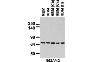 Immunoblot against crude membranes prepared from whole rat (RBM) and mouse (MBM) brain and human cerebral cortex [HBM(Cx)], cerebellum [HBM(Cb)], and hippocampus [HBM(H)] probed with N52A/42 TC supe.