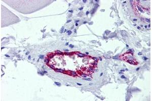 Human Skeletal Muscle, Vessel: Formalin-Fixed, Paraffin-Embedded (FFPE)