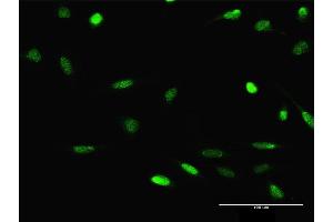 Immunofluorescence of purified MaxPab antibody to JMJD2D on HeLa cell. (JMJD2D 抗体  (AA 1-523))