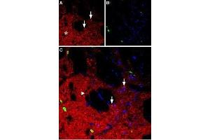 Expression of neuropeptide Y1 receptor in rat striatum - Immunohistochemical staining of rat striatum using Anti-NPY1R Antibody (ABIN7043371, ABIN7044668 and ABIN7044669). (NPY1R 抗体  (AA 237-252))
