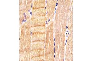 Immunohistochemistry (Paraffin-embedded Sections) (IHC (p)) image for anti-Cyclin-Dependent Kinase 5 (CDK5) antibody (ABIN6242782)