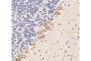 Immunohistochemistry analysis of paraffin-embedded mouse cerebellum using,Dgkz (ABIN7073722) at dilution of 1: 6000 (DGKZ 抗体)