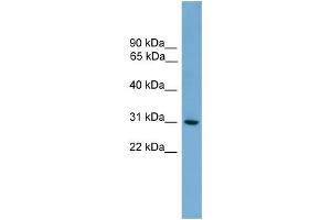 WB Suggested Anti-HLA-DQA2 Antibody Titration:  0. (HLA-DQA2 抗体  (N-Term))