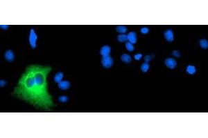 Anti-DPP9 mouse monoclonal antibody (ABIN2455321) immunofluorescent staining of COS7 cells transiently transfected by pCMV6-ENTRY DPP9 (RC224465). (DPP9 抗体)