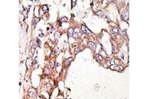 Immunohistochemistry (IHC) image for anti-Small Ubiquitin Related Modifier 4 (SUMO4) antibody (ABIN3032653)