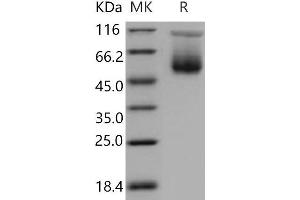 Western Blotting (WB) image for Serine (Or Cysteine) Peptidase Inhibitor, Clade A, Member 3C (SERPINA3C) protein (His tag) (ABIN7320299) (SERPINA3C Protein (His tag))
