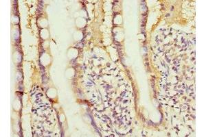 Immunohistochemistry of paraffin-embedded human small intestine tissue using ABIN7167845 at dilution of 1:100 (RBP2 抗体  (AA 1-134))