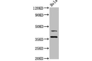 Western Blot Positive WB detected in: Hela whole cell lysate All lanes: DNAJA1 antibody at 3. (DNAJA1 抗体  (AA 8-106))