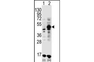 Western blot analysis of GDF9 (arrow) using rabbit polyclonal GDF9 Antibody (M45) (ABIN388822 and ABIN2839140). (GDF9 抗体  (N-Term))