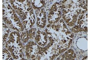 ABIN6275710 at 1/100 staining Mouse testis tissue by IHC-P. (TACC3 抗体  (C-Term))