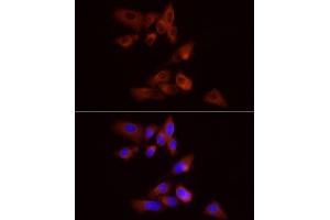 Immunofluorescence analysis of PC-3 cells using PYGB Rabbit pAb  at dilution of 1:100 (40x lens). (PYGB 抗体  (AA 544-843))