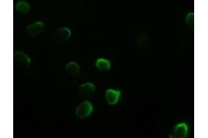 Anti-GATA4 mouse monoclonal antibody (ABIN2452678) immunofluorescent staining of HeLa cells transiently transfected by pCMV6-ENTRY GATA4 (RC210945) (GATA4 抗体  (AA 296-442))