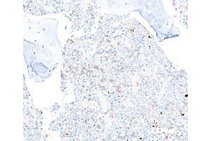 Immunohistochemistry (IHC) image for anti-CD22 Molecule (CD22) (AA 750-800) antibody (ABIN7795736) (Recombinant CD22 抗体  (AA 750-800))