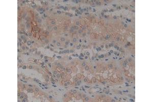 Used in DAB staining on fromalin fixed paraffin- embedded Kidney tissue (PTPRK 抗体  (AA 1185-1440))