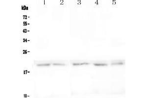 Western blot analysis of BCMA using anti-BCMA antibody .