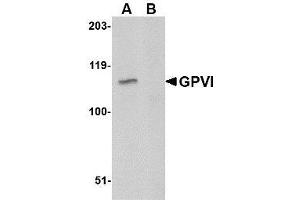 Western blot analysis of GPVI in A20 lysate with AP30378PU-N GPVI antibody at 1μg/ml in either the absence or (B) the presence of blocking peptide. (GP6 抗体  (C-Term))