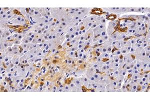 Immunohistochemistry (IHC) image for anti-Keratin 19 (KRT19) (AA 245-391) antibody (ABIN7433303)