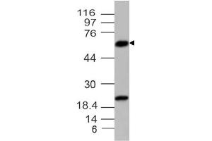 Image no. 1 for anti-Parathyroid Hormone (PTH) (AA 1-236) antibody (ABIN5027427) (PTH 抗体  (AA 1-236))