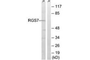 Western blot analysis of extracts from Jurkat cells, using RGS7 Antibody. (RGS7 抗体  (AA 155-204))