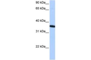 Western Blotting (WB) image for anti-Zinc Finger Protein 192 Pseudogene 1 (ZNF192P1) antibody (ABIN2463407) (ZNF192P1 抗体)