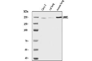 Western blot analysis of Laminin Gamma 1/LAMC1 using anti-Laminin Gamma 1/LAMC1 antibody (ABIN7602455).
