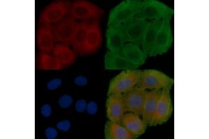 ABIN6262446 and ABIN6278479 staining Hela cells(30 min of UV treatment) by IF/ICC. (IDH3B 抗体  (N-Term))