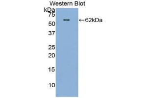 Western blot analysis of the recombinant protein. (HGF 抗体  (AA 32-291))