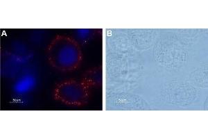 Immunocytochemistry (ICC) image for anti-Coagulation Factor II (thrombin) Receptor (F2R) (AA 61-76), (Extracellular) antibody (ABIN7043073)