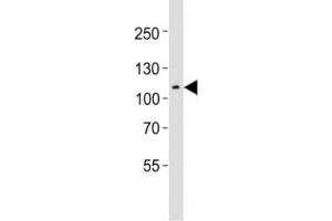 Western blot testing of Mertk antibody at 1:1000 dilution + mouse spleen lysate; Predicted molecular weight: 110~205 kDa depending on glycosylation level (MERTK 抗体  (C-Term))