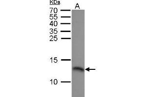WB Image RPA14 antibody detects RPA14 protein by Western blot analysis. (RPA3 抗体)
