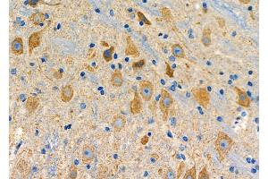 ABIN6265688 and ABIN6278646 at 1/100 staining Mouse brain tissue by IHC-P. (Tryptophan Hydroxylase 2 抗体  (N-Term))