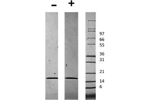 SDS-PAGE of Human Chemerin Recombinant Protein SDS-PAGE of Human Chemerin Recombinant Protein. (Chemerin 蛋白)