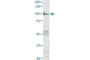 Immunoprecipitation of ITGB6 transfected lysate using anti-ITGB6 MaxPab rabbit polyclonal antibody and Protein A Magnetic Bead , and immunoblotted with ITGB6 purified MaxPab mouse polyclonal antibody (B01P) . (ITGB6 抗体  (AA 1-788))